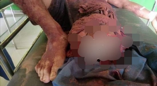 Personil Polsek Bangko Pusako Berhasil Amankan Pelaku Pembacokan