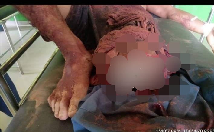 Personil Polsek Bangko Pusako Berhasil Amankan Pelaku Pembacokan
